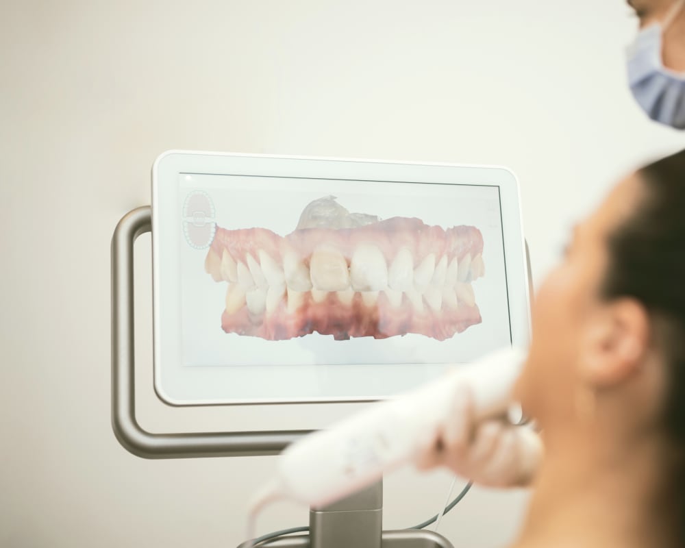 Invisalign traitement 3D, Dentiste à l'Ouest de l'Île